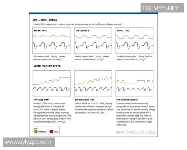 独家分析：西安乒乓球队的比赛经验对比_1
